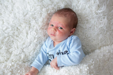 infant skin care