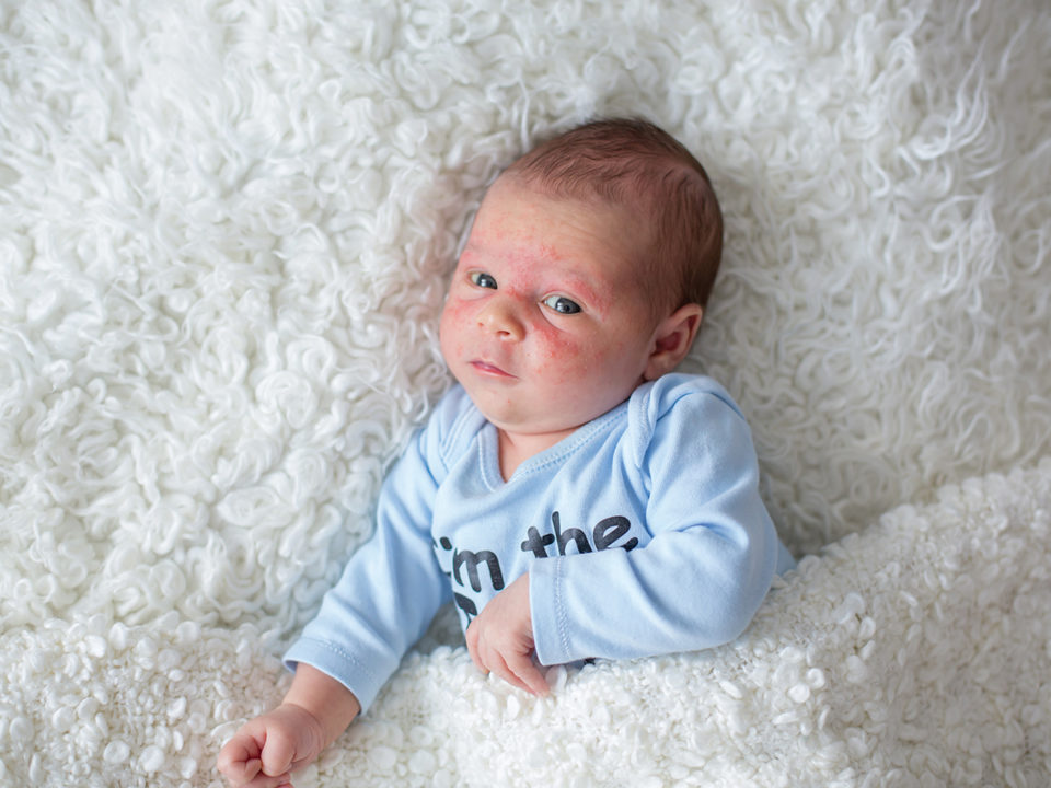 infant skin care
